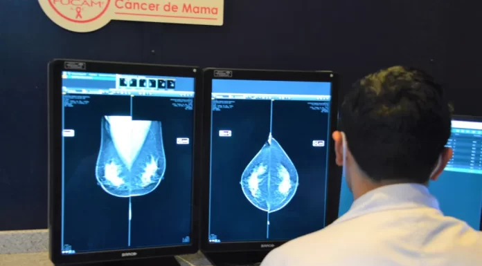 El Sistema de Salud Gto suma 42 mil mastografías y 72 mil exploraciones de mama este 2022
