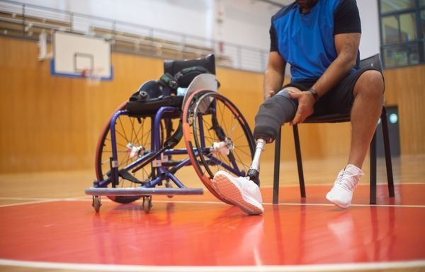 Gobierno de Guanajuato apoya a 18 personas con prótesis