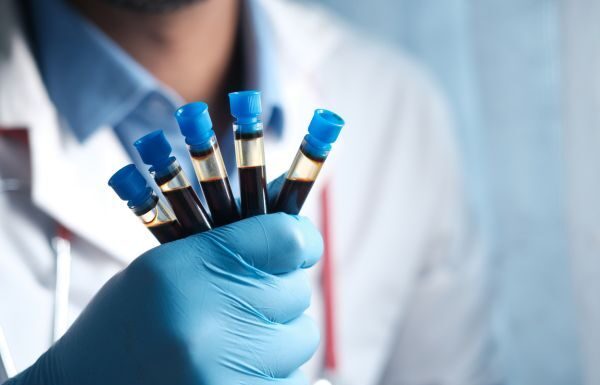 Dan positivo 23% de casos estudiados de dengue en León: SSG