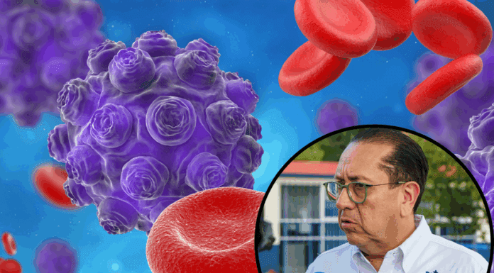 Guanajuato en alerta epidemiolótgica por sarampión