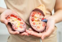 Convoca IMSS Guanajuato a vigilar tu salud renal