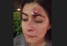 Asaltan y golpean brutalmente a artista local dentro del Forum Cultural León