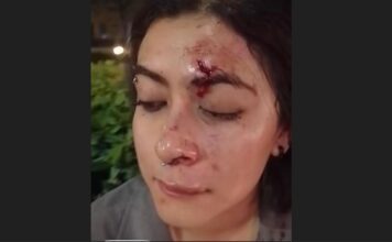 Asaltan y golpean brutalmente a artista local dentro del Forum Cultural León
