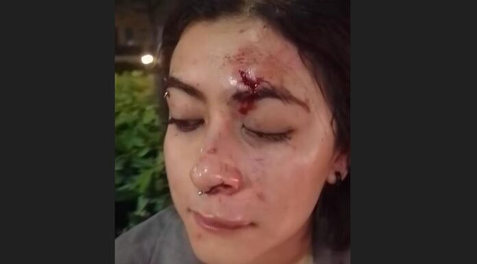 Asaltan y golpean brutalmente a artista local dentro del Forum Cultural León