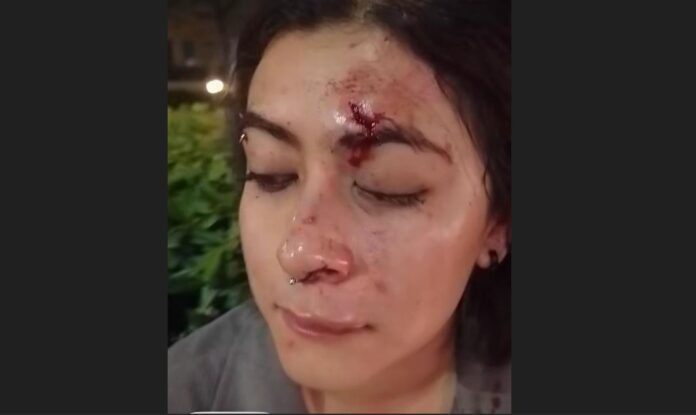 mujer lesionada