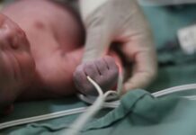 Atiende Salud Guanajuato a dos hermanitas con 33 semanas de gestación