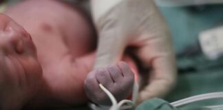 Atiende Salud Guanajuato a dos hermanitas con 33 semanas de gestación