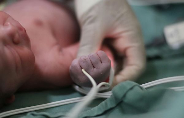 Atiende Salud Guanajuato a dos hermanitas con 33 semanas de gestación